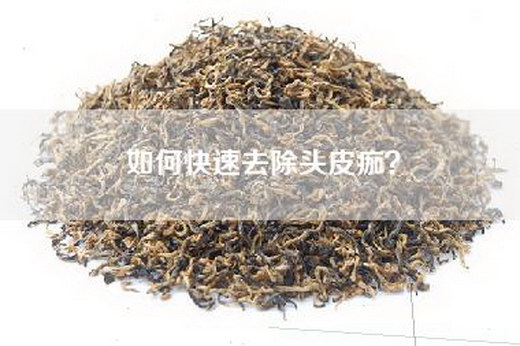 如何快速去除头皮痂？