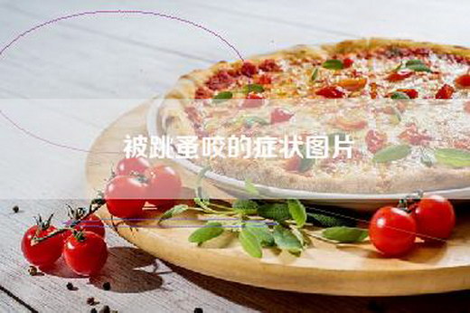 被跳蚤咬的症状图片